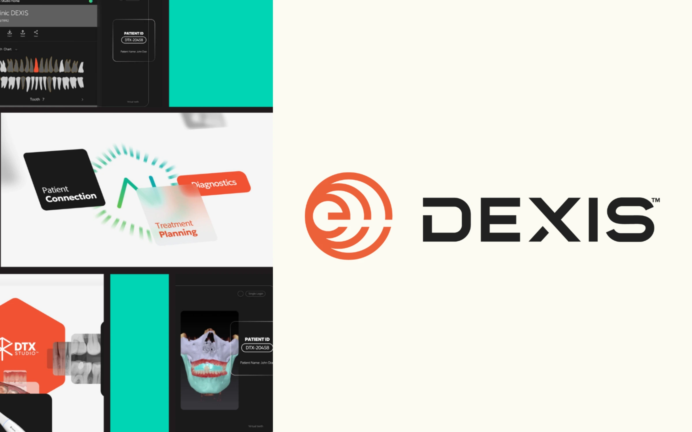 Dexis: 738,000+ Views for a B2B Dental Software Explainer